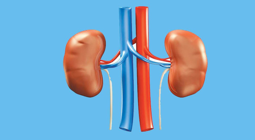 मिर्गौला पत्थरी  बिरामीले के खान हुन्छ, के हुँदैन ?